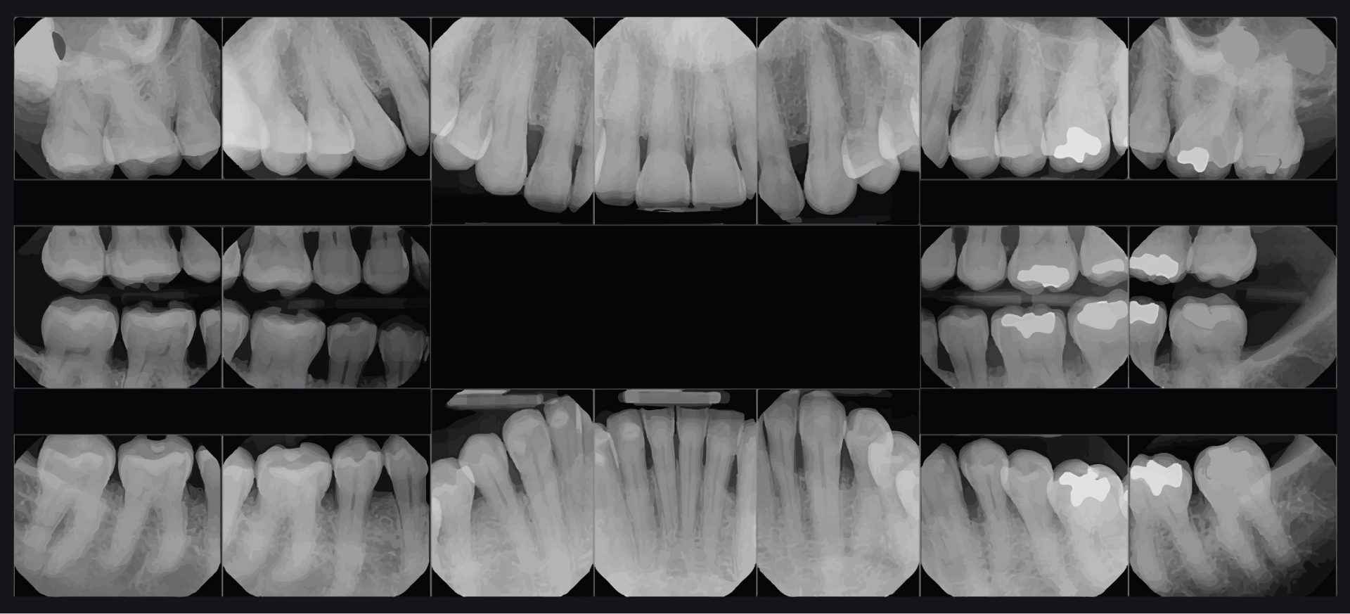 xray